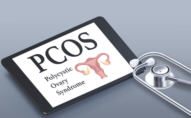 Understanding PCOS: Symptoms, Causes, Diagnosis, and Treatment Options