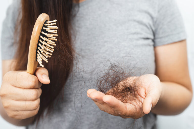 Understanding Hair Loss: Causes, Connections, and Treatment Options